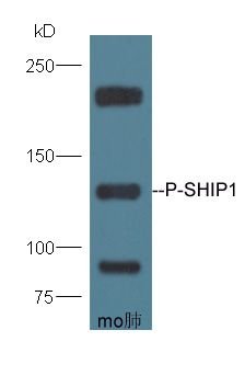 SHIP1 (phospho-Tyr1020) antibody